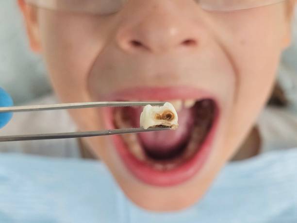 Best Pediatric Emergency Dentist in Ely, IA